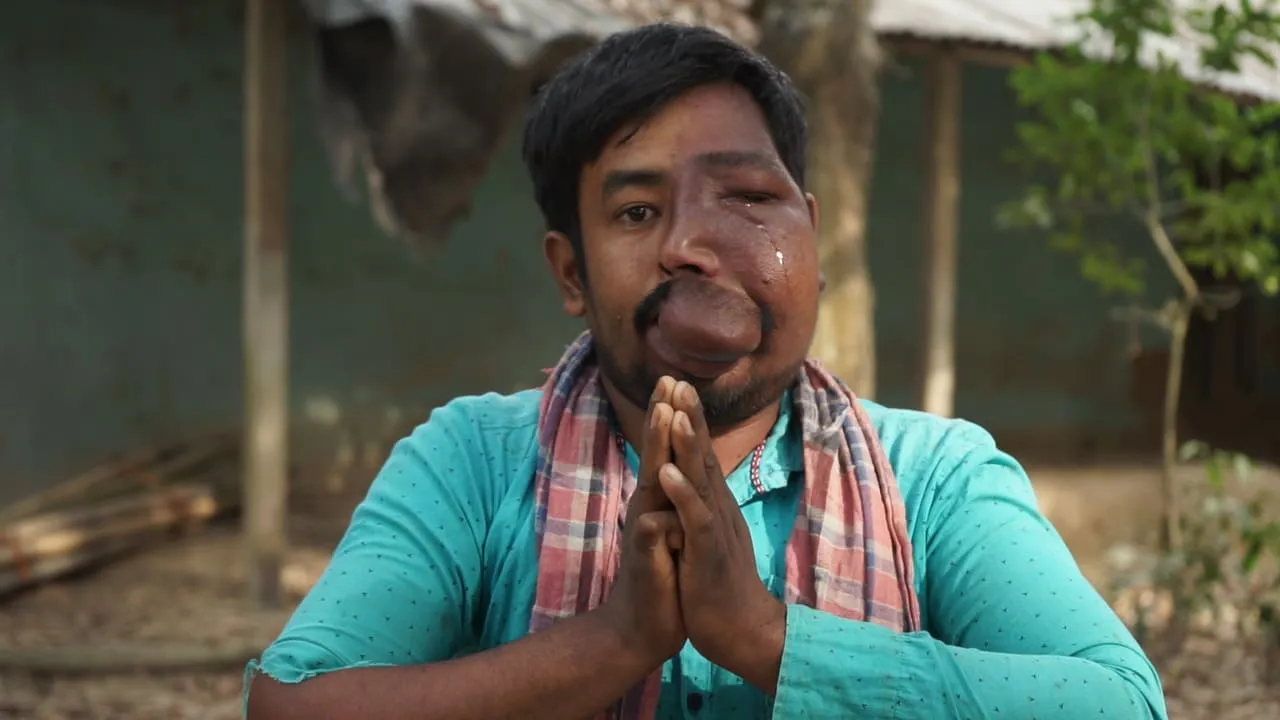 One Surgery. One Chance. One Life Changed – Support Nipen Today