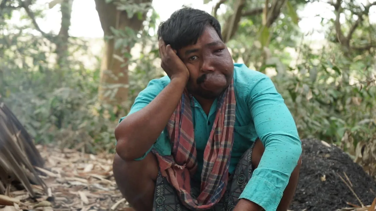 One Surgery. One Chance. One Life Changed – Support Nipen Today