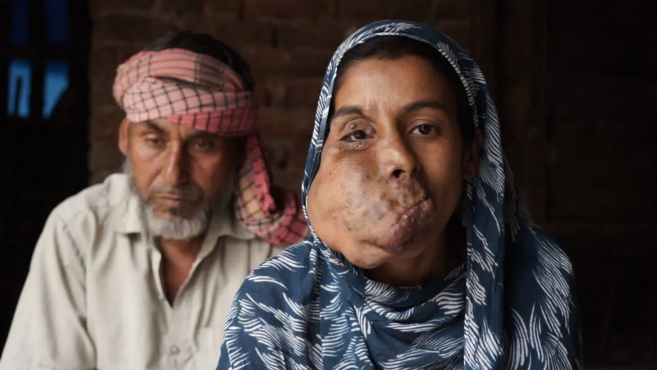 Trapped by Pain, Silenced by Stares — Mosima Needs Us to Help Her Heal
