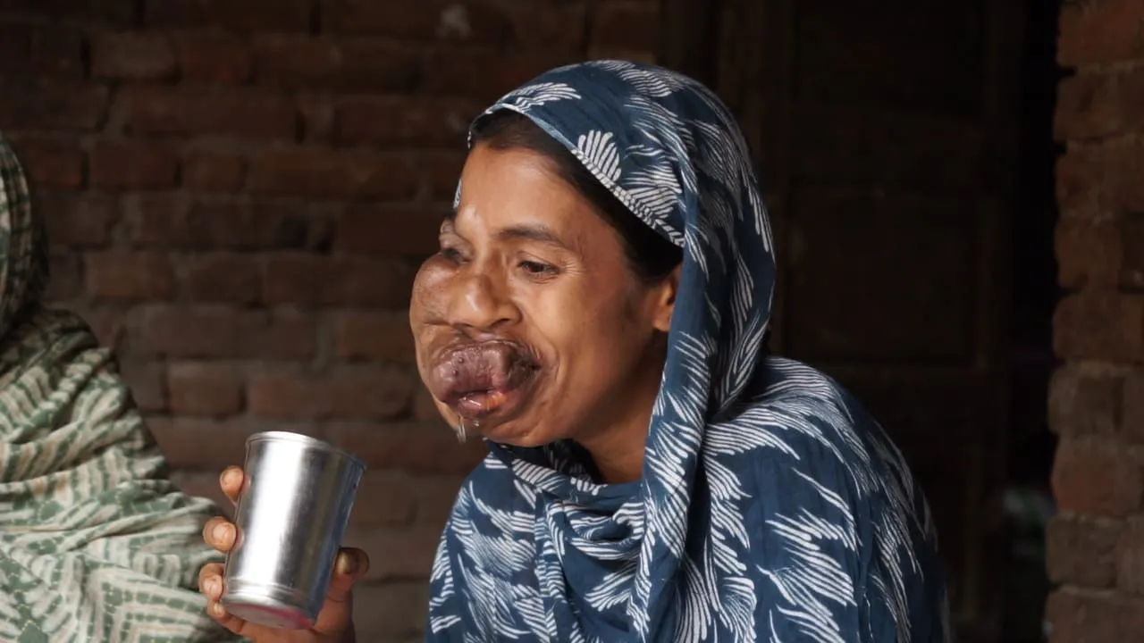 Trapped by Pain, Silenced by Stares — Mosima Needs Us to Help Her Heal