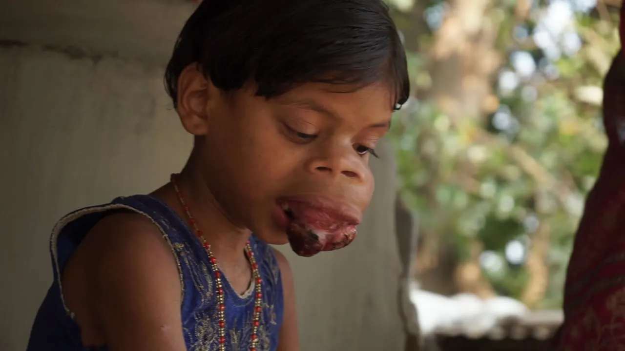 Ya Allah, please dont let my daughter suffer like this. Help me save my child with urgent surgery