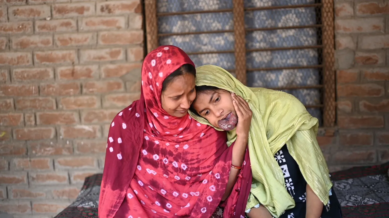Help Asha See a Brighter Tomorrow – She Needs Urgent Surgery!