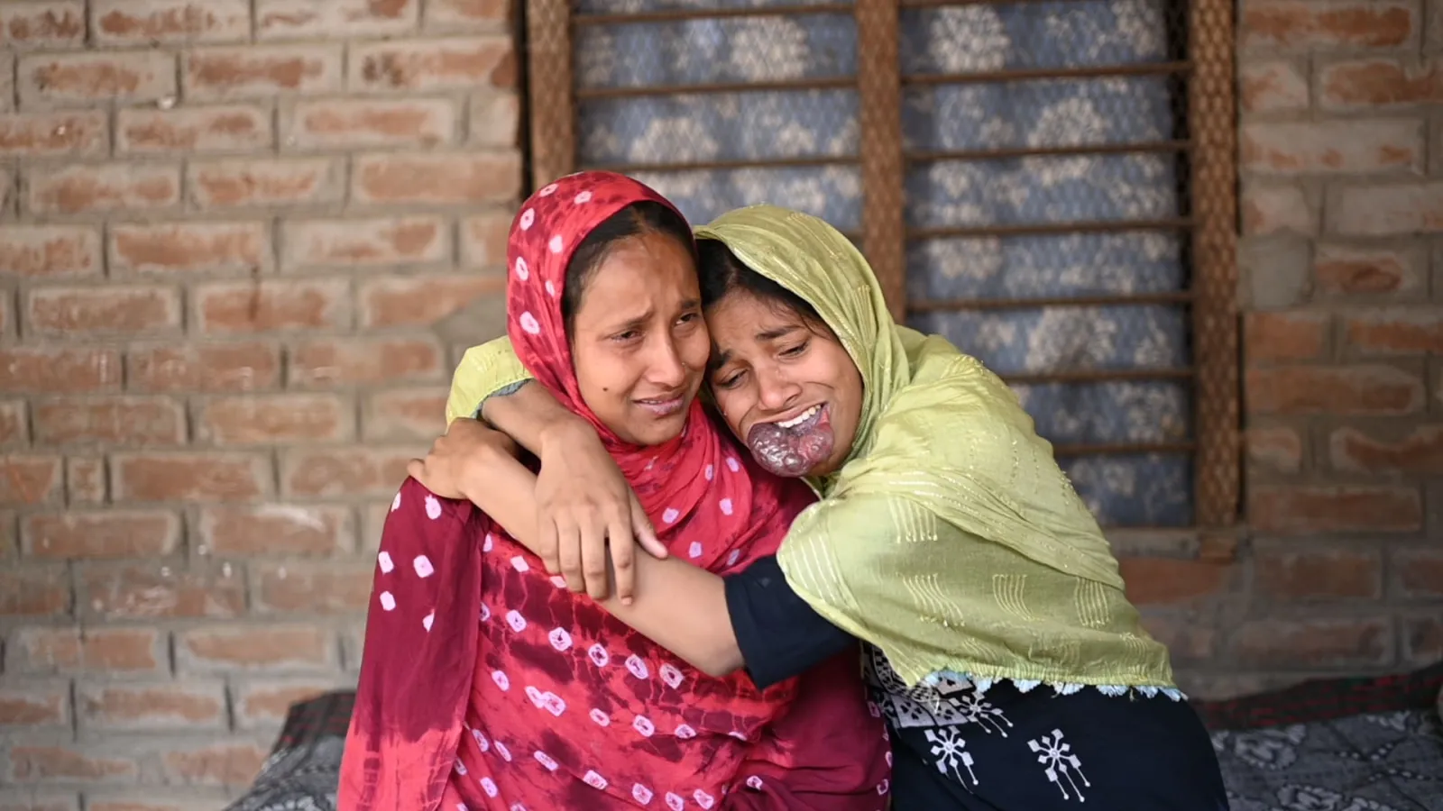Help Asha See a Brighter Tomorrow – She Needs Urgent Surgery!