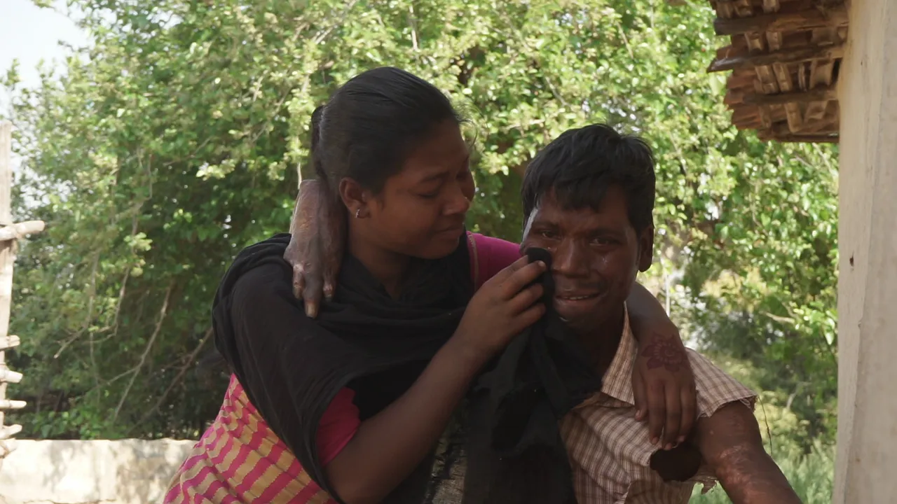 Help Kuldeep Hold His Children Again – Restore His Hands, Restore His Hope