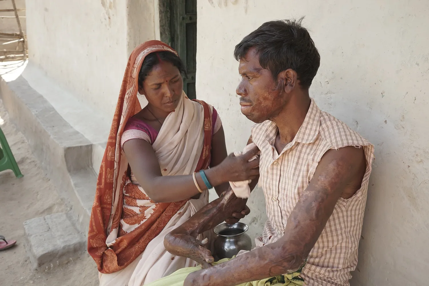 Help Kuldeep Hold His Children Again – Restore His Hands, Restore His Hope