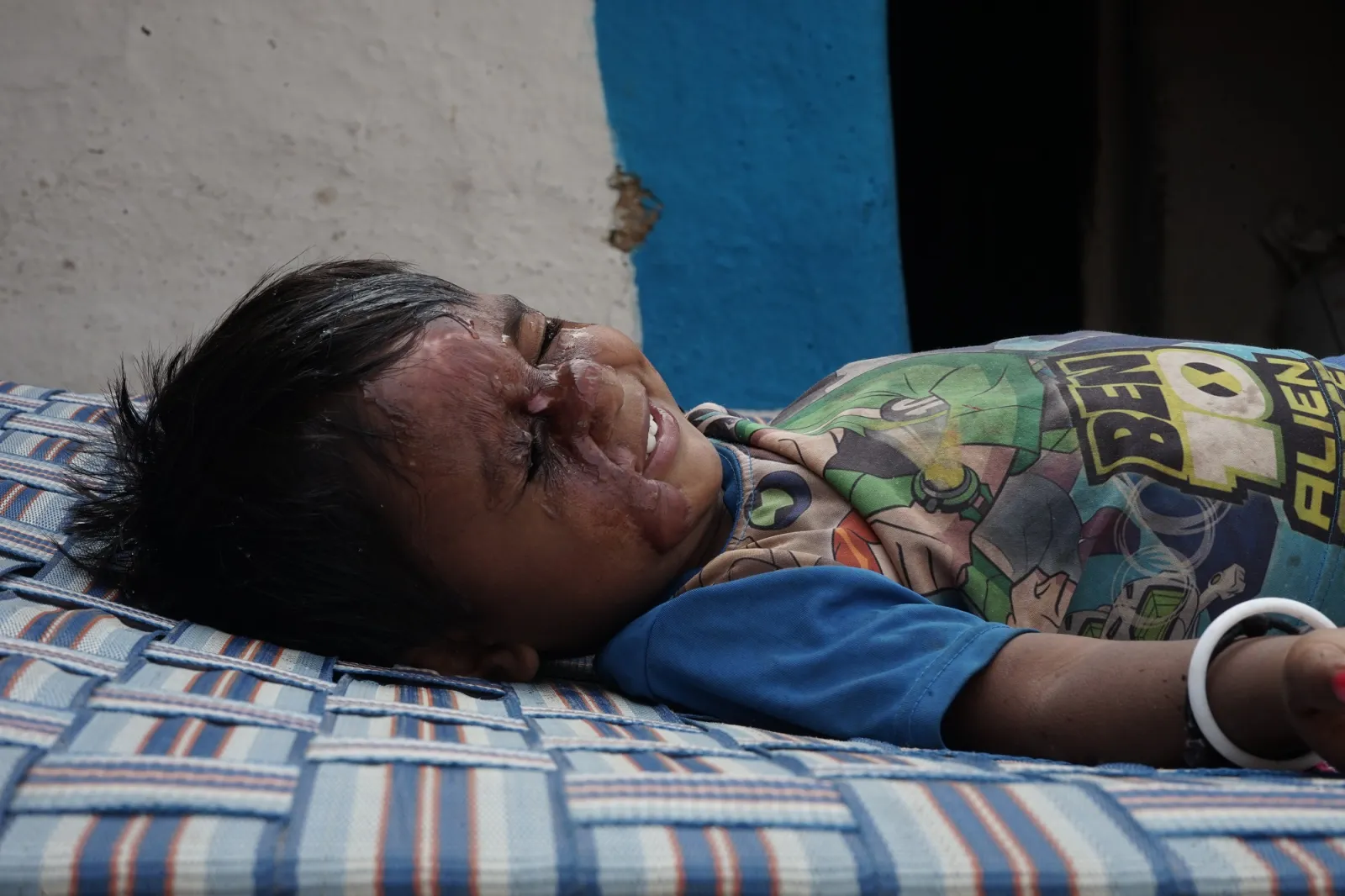 Sachin's Scarred Smile: A Plea for Help