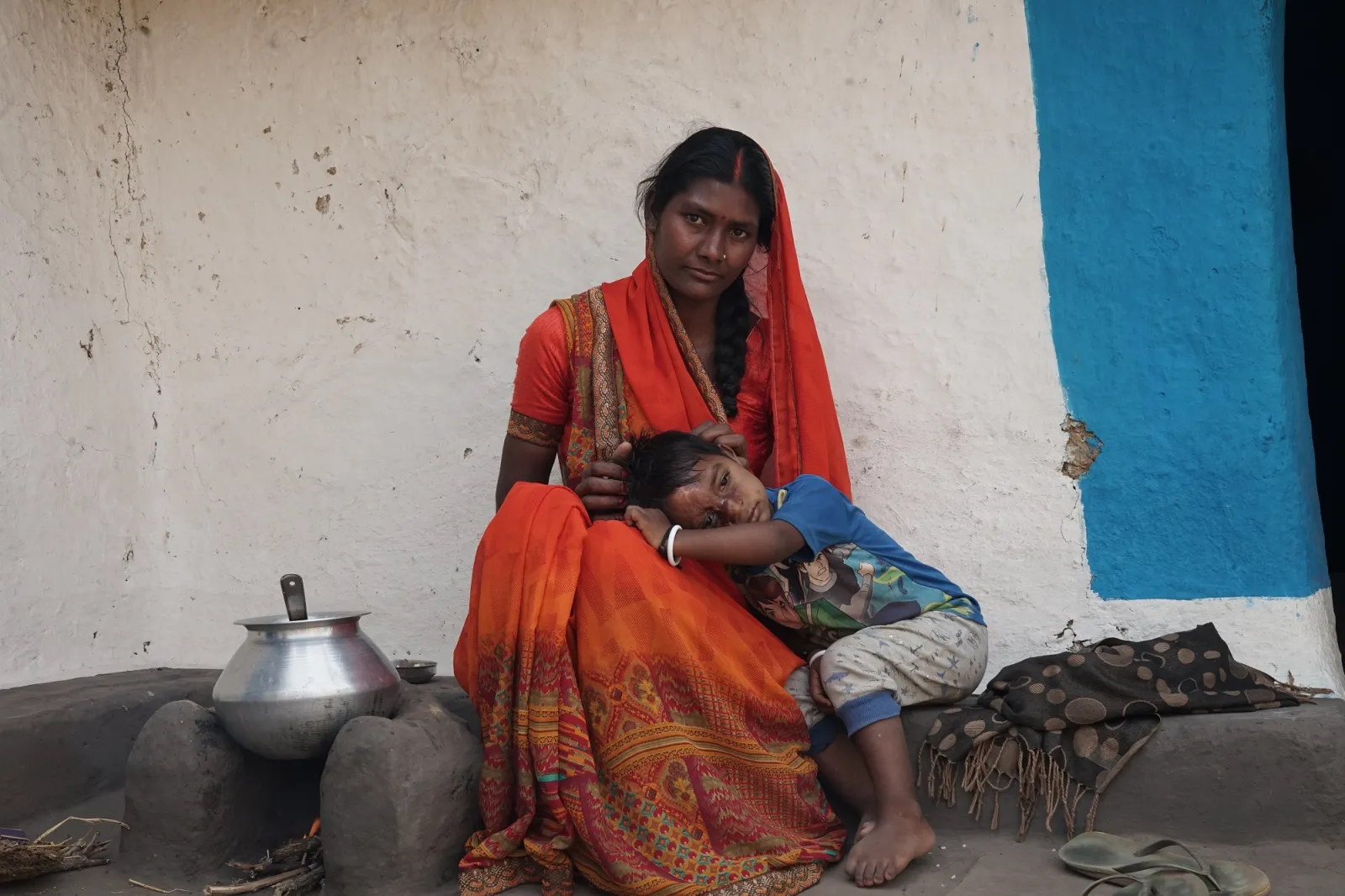 Sachin's Scarred Smile: A Plea for Help