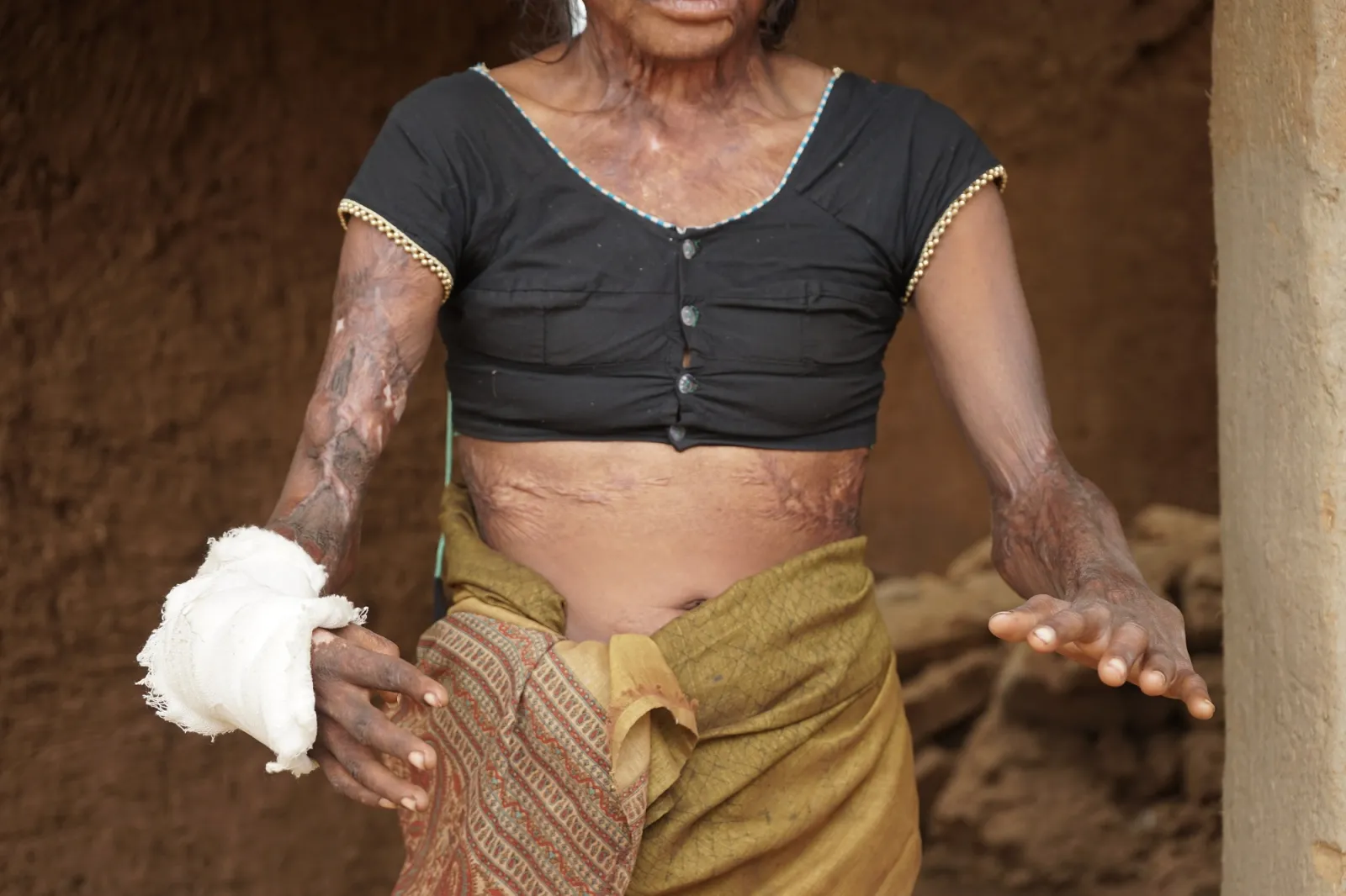Pushpa's Silent Struggle: A Daughter's Hope for a Better Tomorrow
