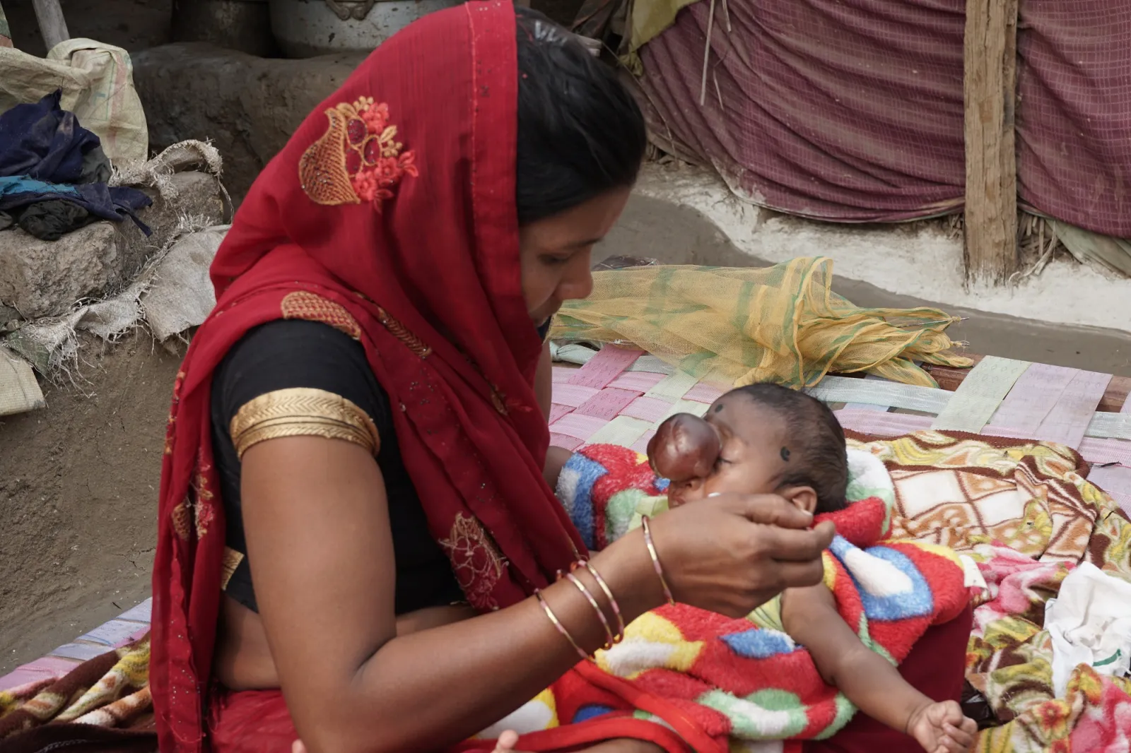 A Tiny Heart, a Mighty Fight: Sarthi's Battle for Life