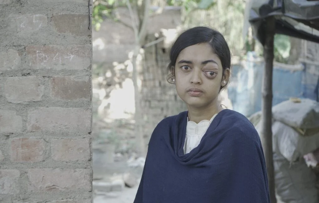 Your Support Can Change Sagira’s Life – Act Now!