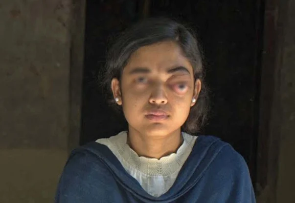 Your Support Can Change Sagira’s Life – Act Now!