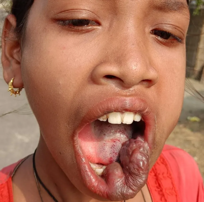 I Beg For Food, But Today I am Begging For My Sisters Treatment. Please Save Her.
