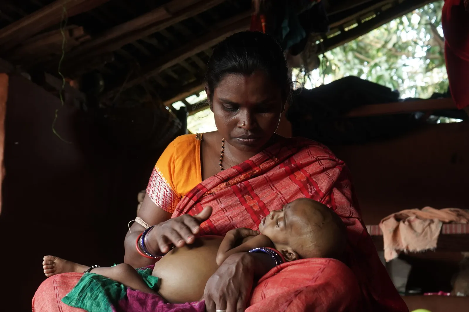 She Is 10 Months Old. Her Father Sweeps Homes to Feed Five People. Now One of Them Is Dying.