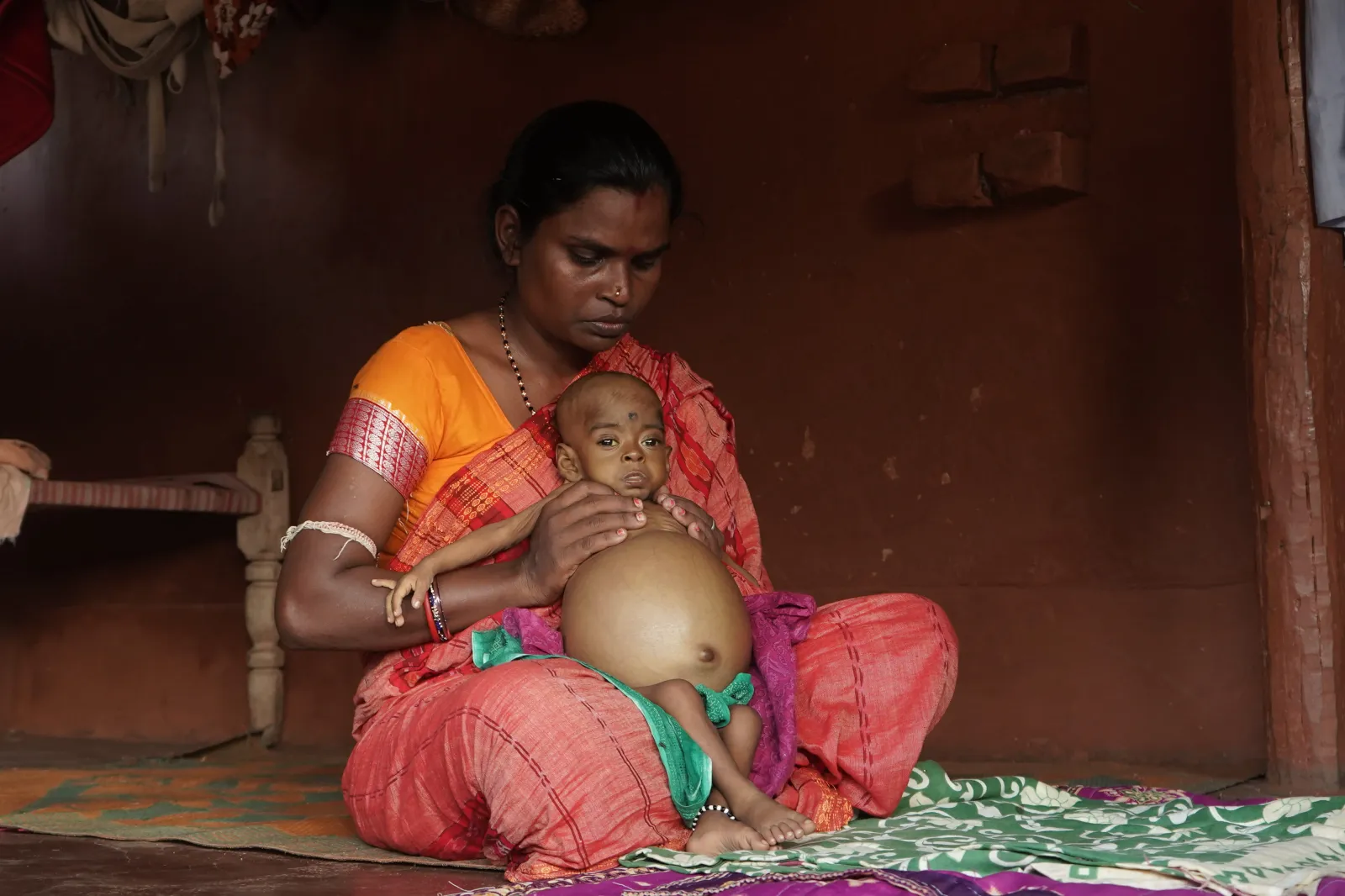 She Is 10 Months Old. Her Father Sweeps Homes to Feed Five People. Now One of Them Is Dying.