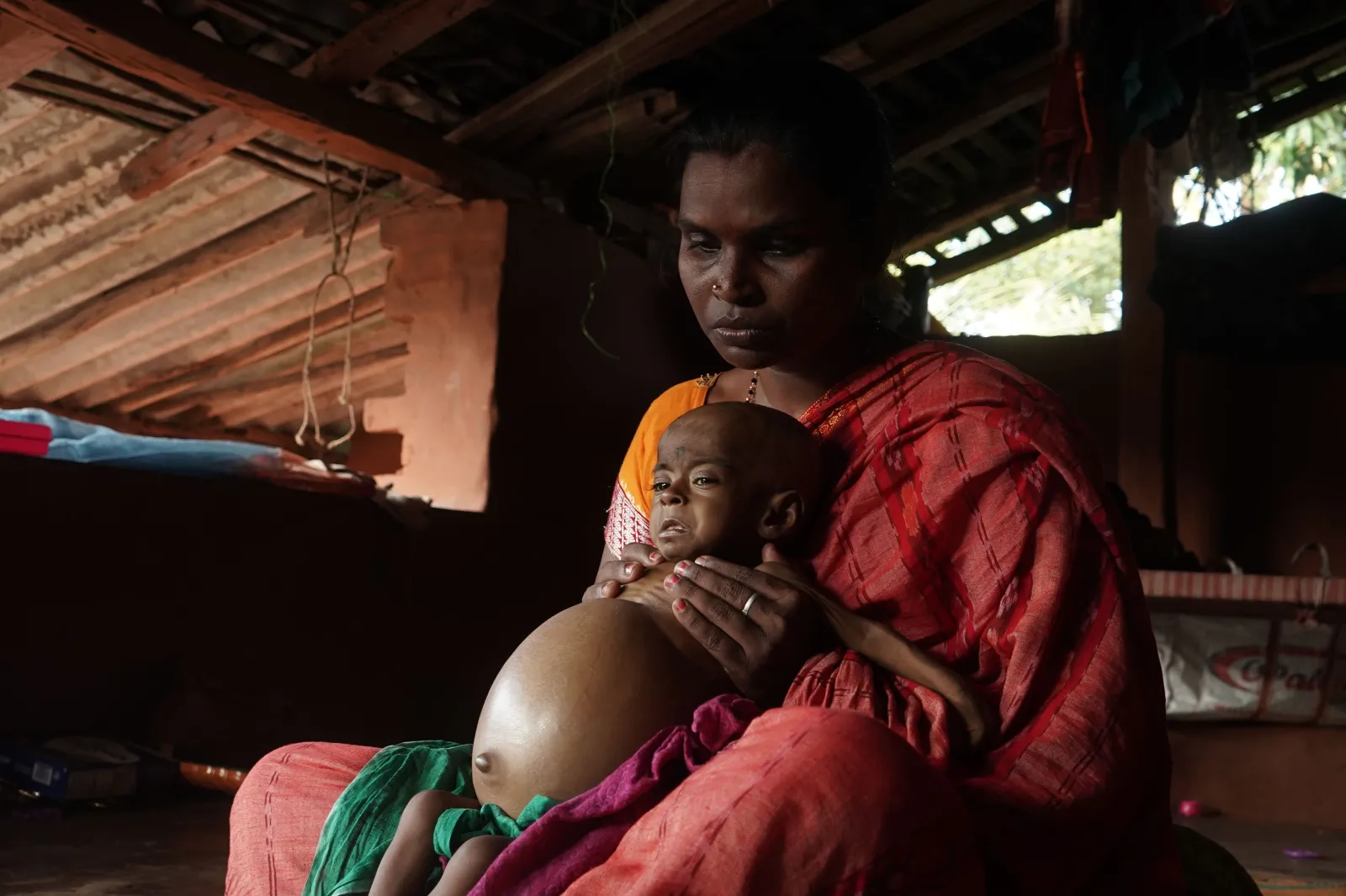 She Is 10 Months Old. Her Father Sweeps Homes to Feed Five People. Now One of Them Is Dying.