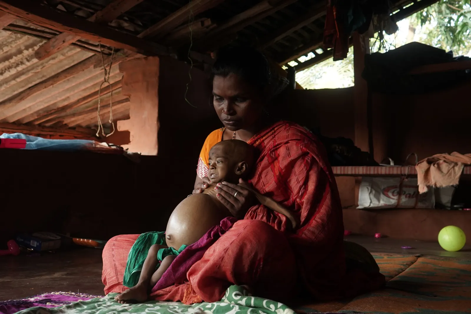 She Is 10 Months Old. Her Father Sweeps Homes to Feed Five People. Now One of Them Is Dying.