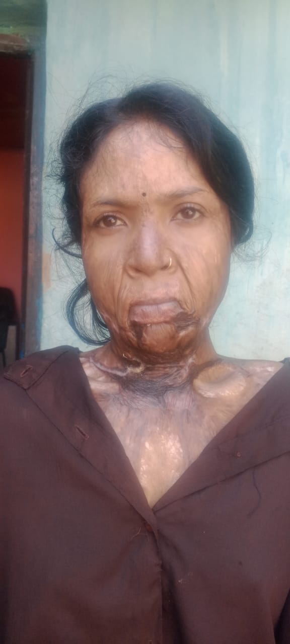 Rising Again After the Fire